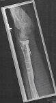 Arm l2.jpg